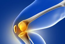 Diz Protezi Ameliyatı Nedir? Diz Protezi Ameliyatı