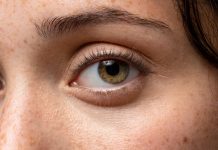 Sarı Nokta Hastalığı Nedir? Sarı Nokta Hastalığı Nedir?